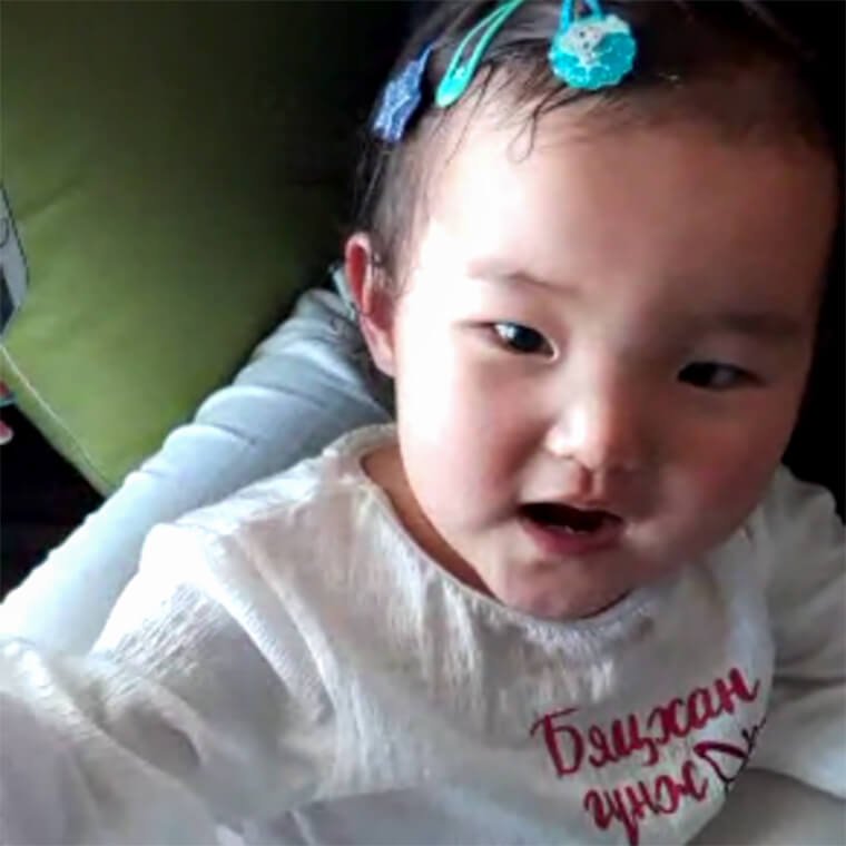 Enkhsaruul was diagnosed with a heart defect at birth.